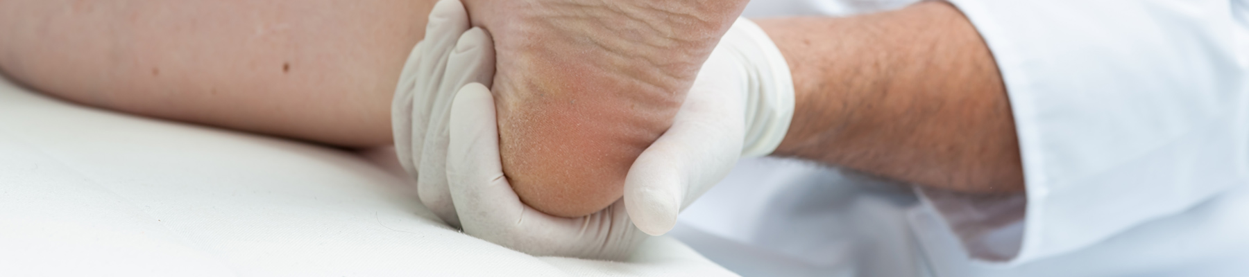Calgary Podistrist examining bunions Podiatrist and Foot Calgary