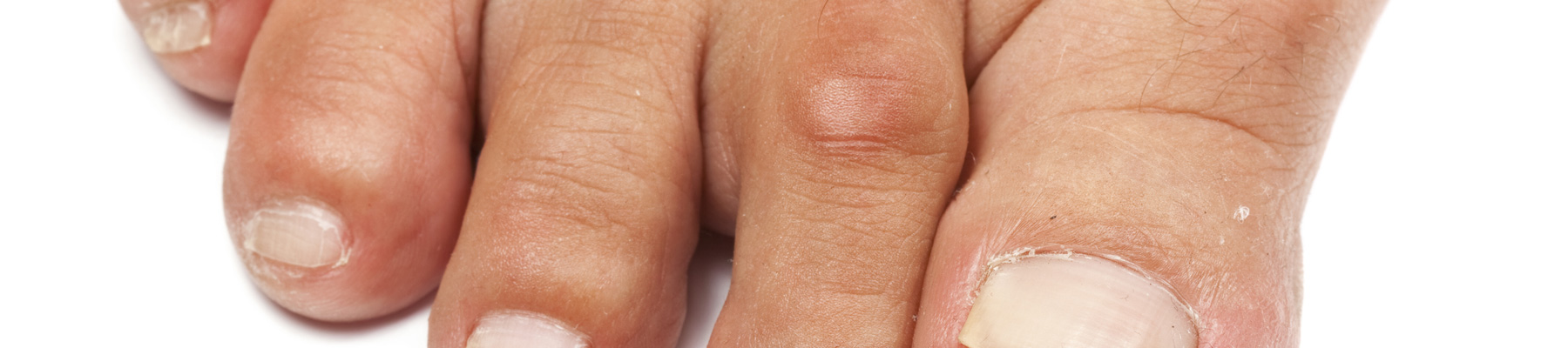 Podiatrist and Foot Doctor in Calgary